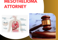 Mesothelioma Attorney