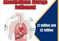 Mesothelioma Average Settlement