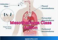 Mesothelioma Class Action