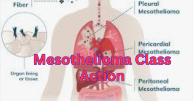 Mesothelioma Class Action