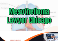 Mesothelioma Lawyer Chicago