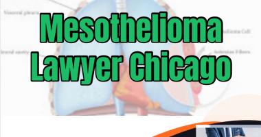 Mesothelioma Lawyer Chicago