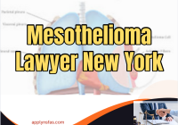 Mesothelioma Lawyer New York