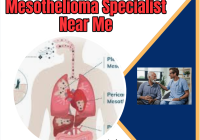 Mesothelioma Specialist Near Me